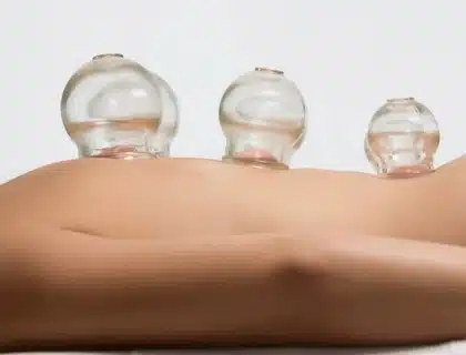 Schroepfmassage in Basel ThaiVital